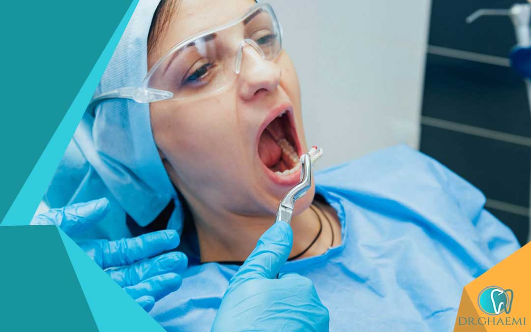 جراحی دندان عقل در تهرانپارس