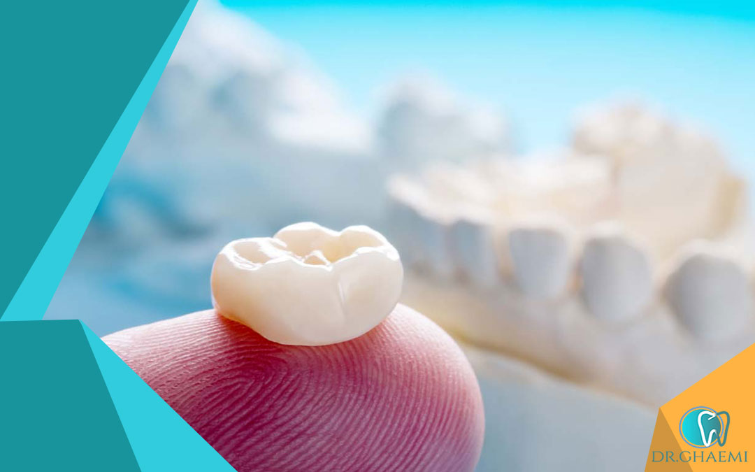 تفاوت دندانپزشکی قائمی با سایر دندانپزشکی‌ها در درمان پروتز پارسیل