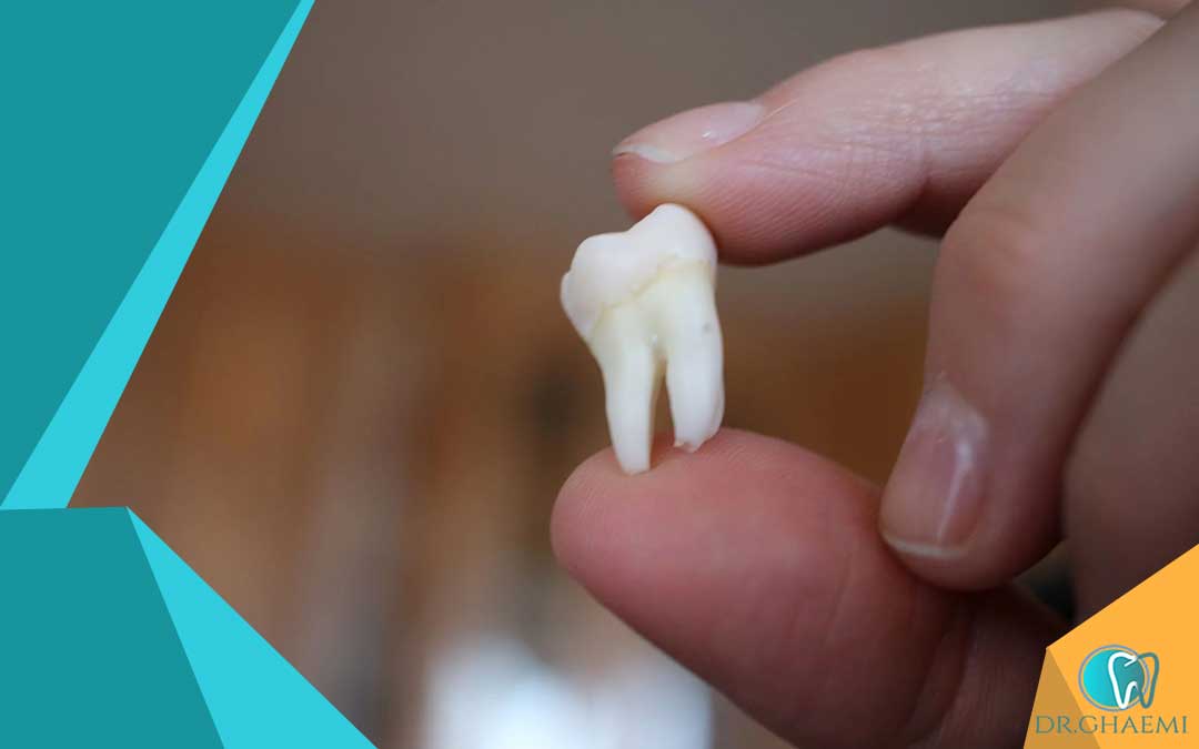 علائم التهاب پس از کشیدن دندان