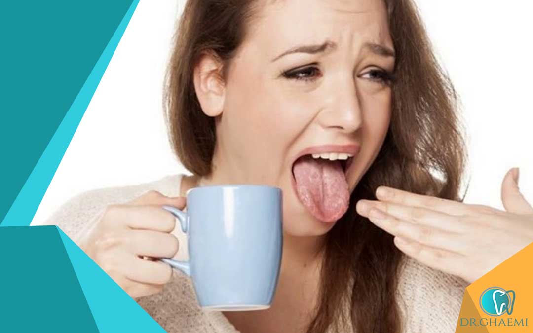 آیا سندرم سوزش دهان انواع مختلفی دارد؟
