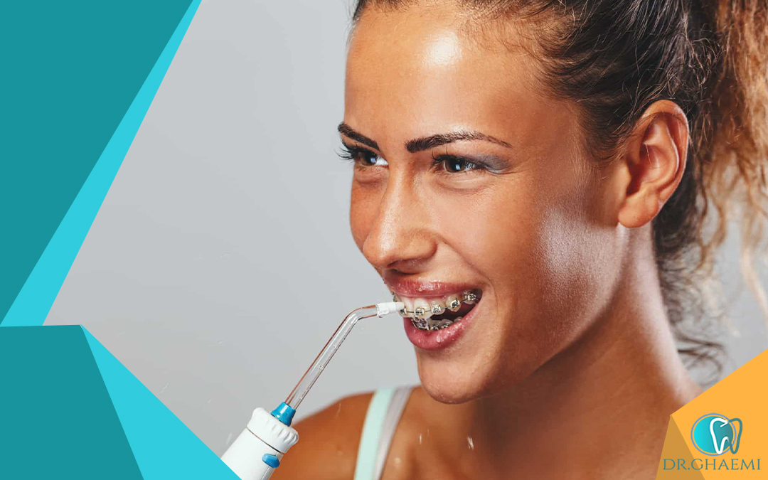 نخ دندان برای تمیز کردن فواصل دندان‌ها بهتر است یا واترجت؟