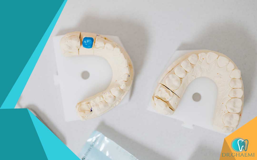 دندانپزشکی تحت پوشش بیمه چگونه کار می کند؟