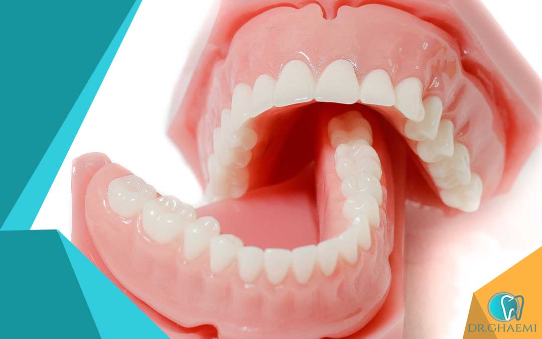 هنگام استفاده از دندان مصنوعی چه نکاتی را باید در نظر گرفت؟