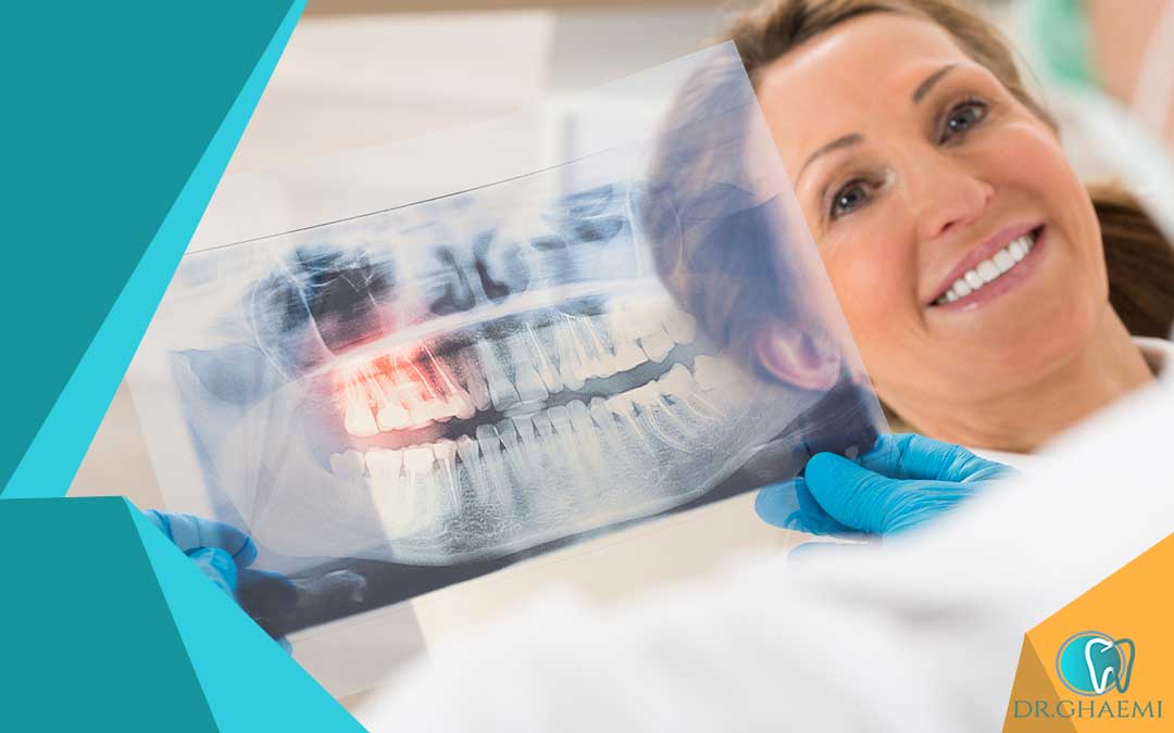  دندانپزشکی بدون درد حتی بعد از درمان