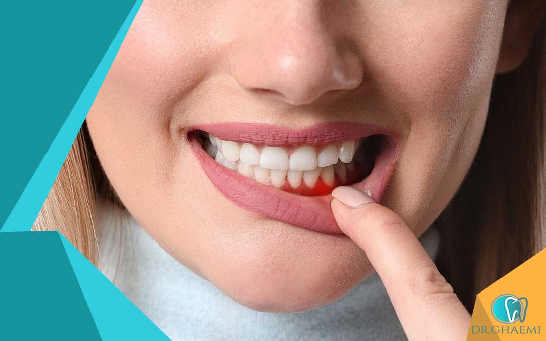 علائم عفونت بعد از کشیدن دندان چیست؟