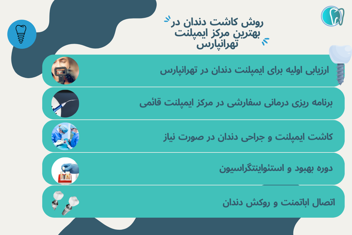 روش کاشت دندان در بهترین مرکز ایمپلنت تهرانپارس