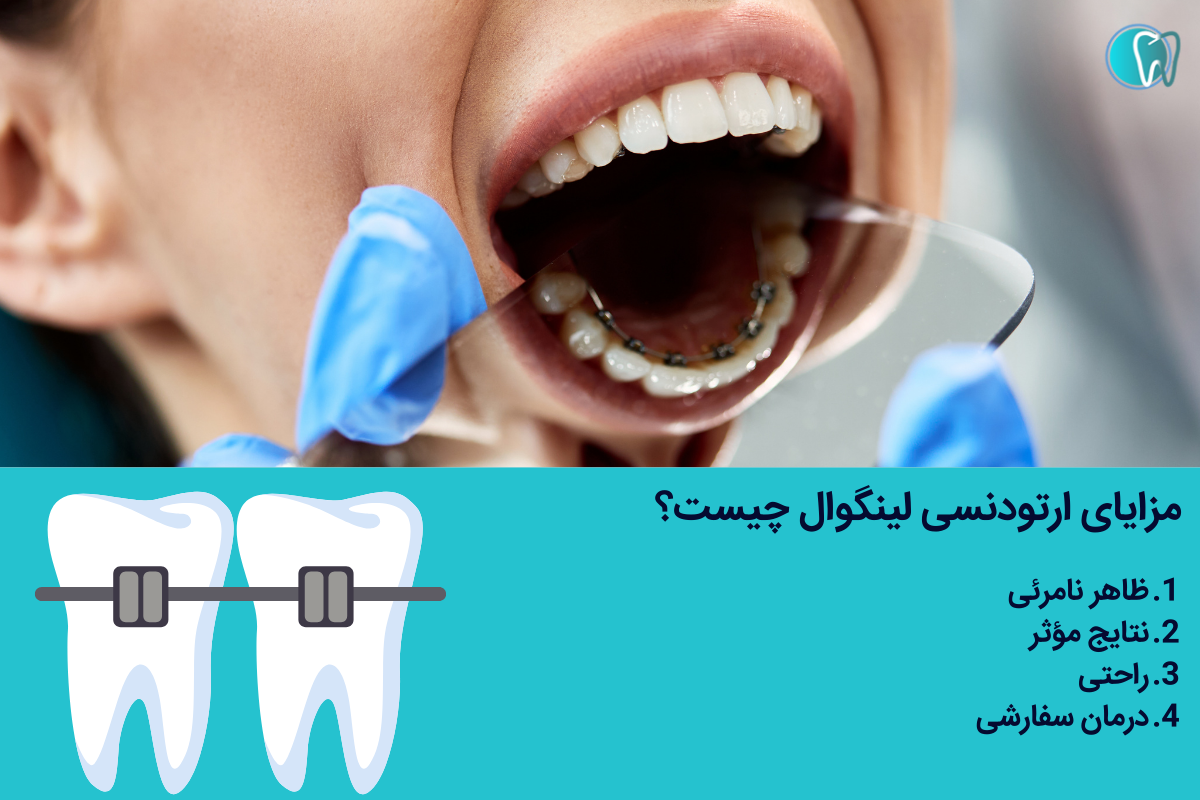 مزایای ارتودنسی لینگوال چیست؟