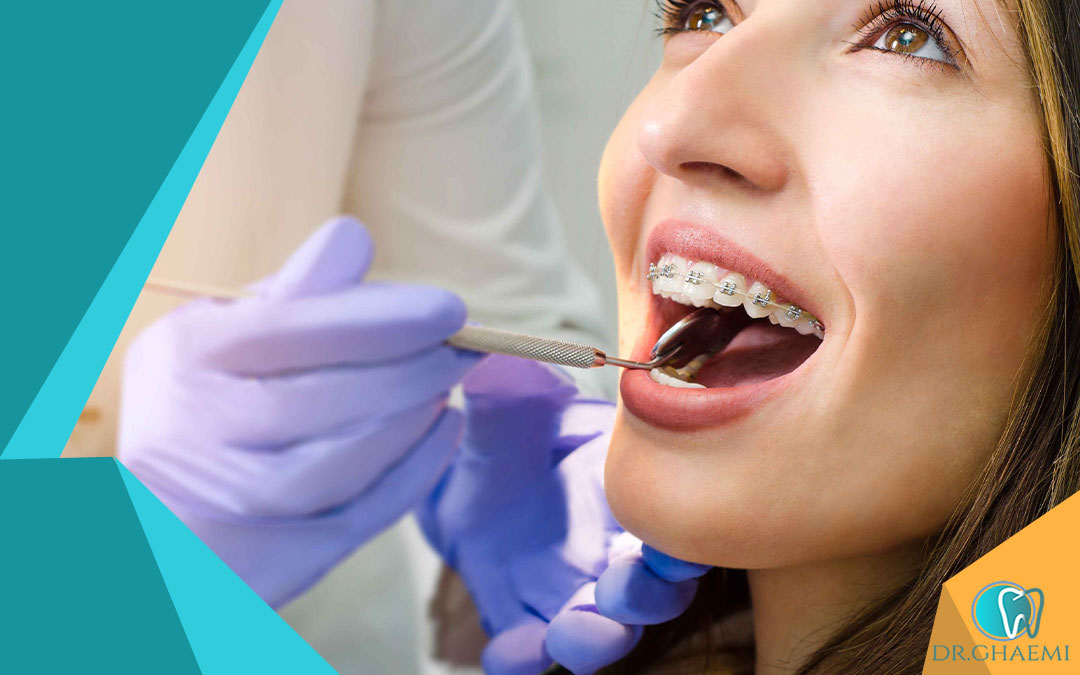 معایب و خطرات ارتودنسی یک دندان