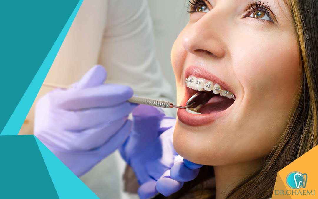 نکات مهم در خصوص جلسه اول مشاوره ارتودنسی دندان