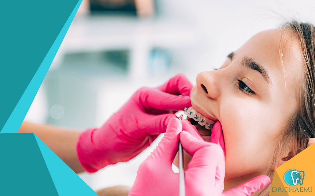 مزایای ارتودنسی یک دندان چیست؟