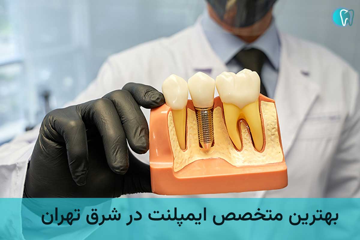 متخصص ایمپلنت دندان در شرق تهران