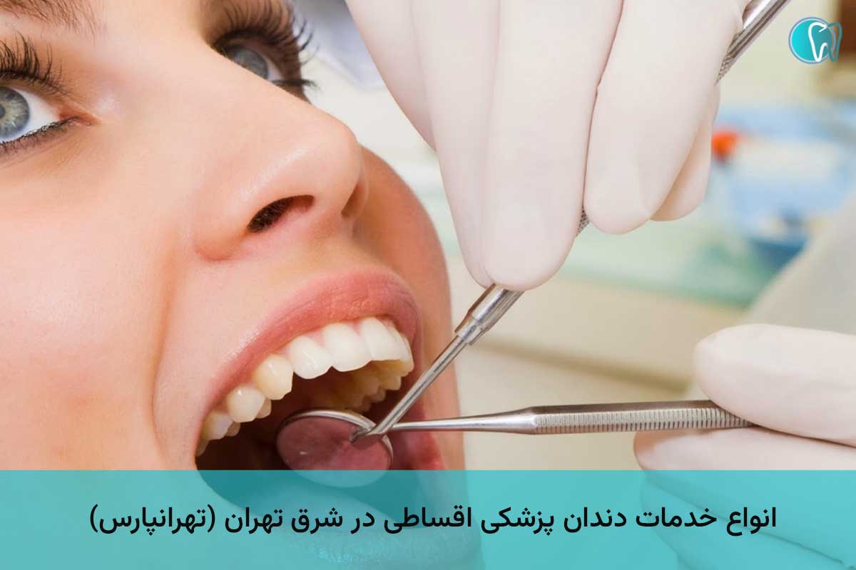 انواع خدمات دندان پزشکی اقساطی در شرق تهران (تهرانپارس)