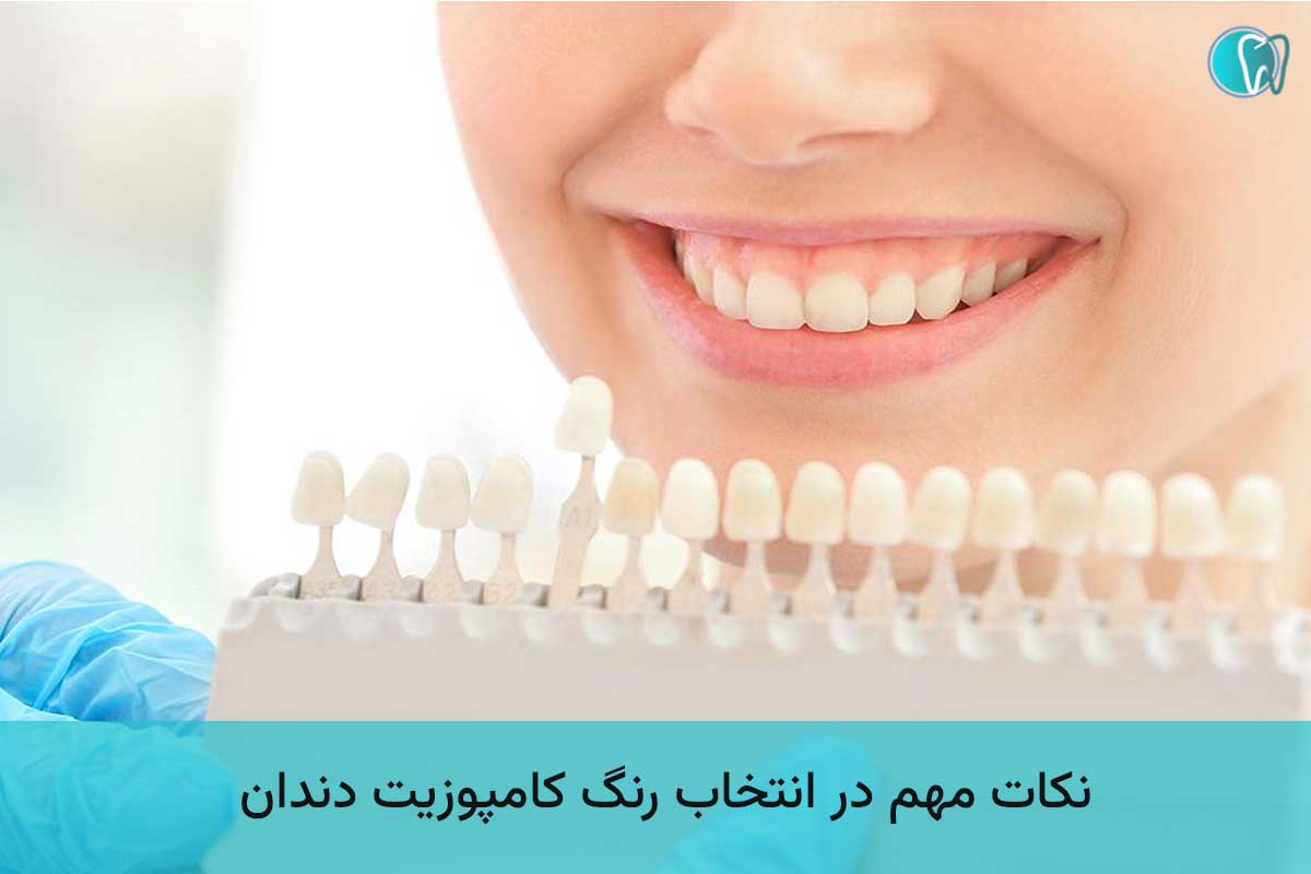نکات مهم در انتخاب رنگ کامپوزیت دندان 
