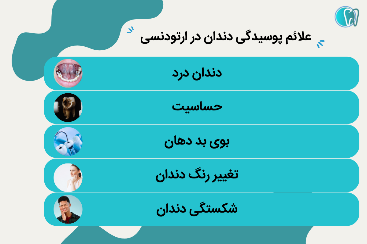 مهمترین دلایل پوسیدگی دندان در ارتودنسی چیست؟ 2 علائم پوسیدگی دندان در ارتودنسی