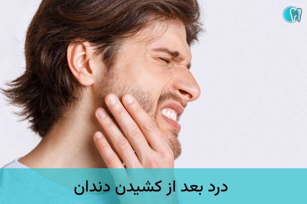 درد بعد از کشیدن دندان
