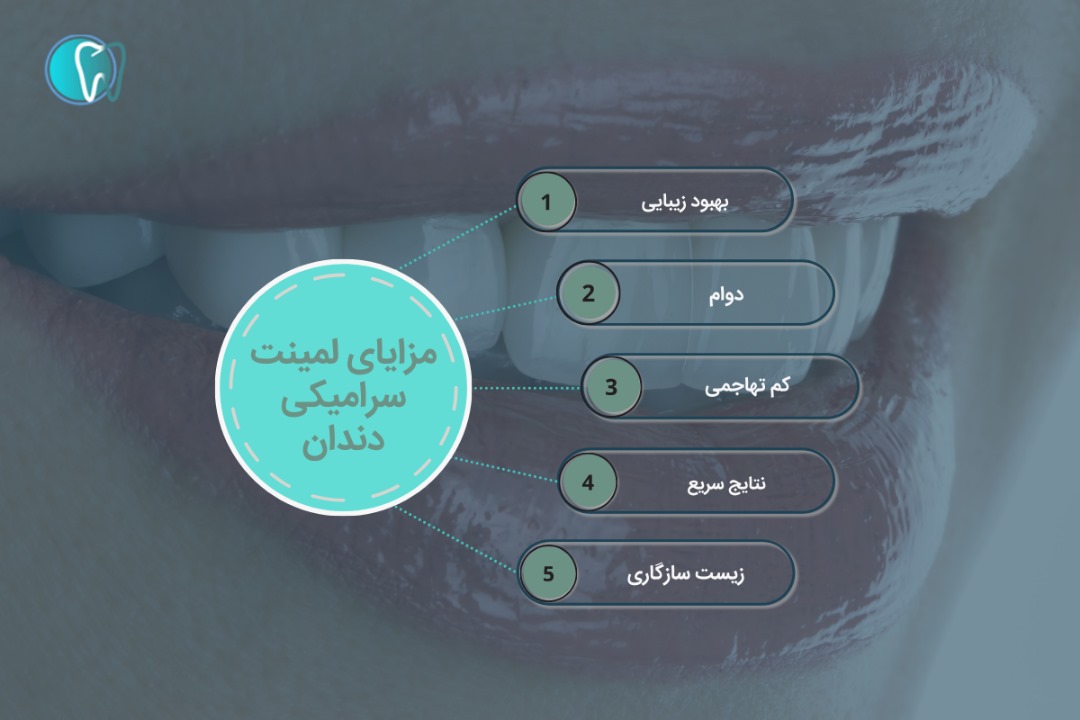 مزایای لمینت سرامیکی دندان