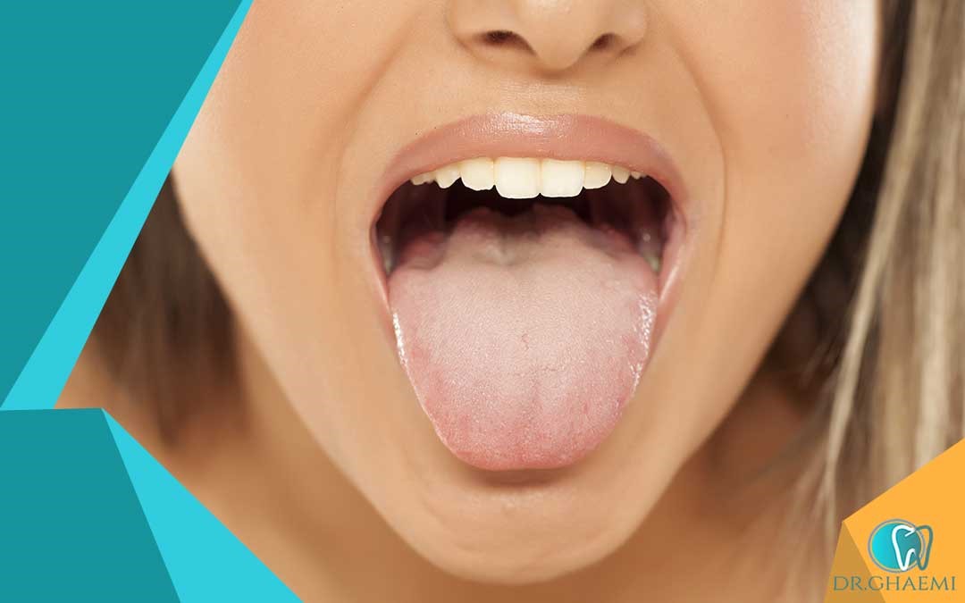 بیماری زمینه ای علت سوزش زبان