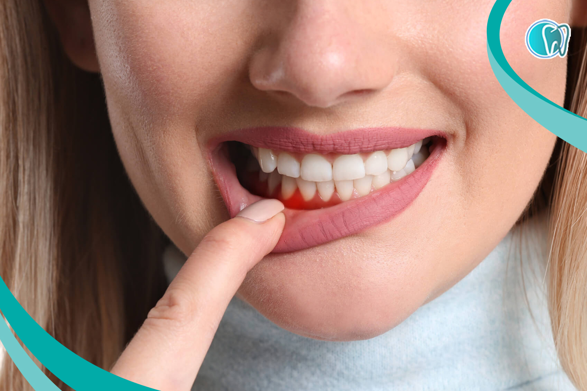 سؤالات متداول حساسیت لثه