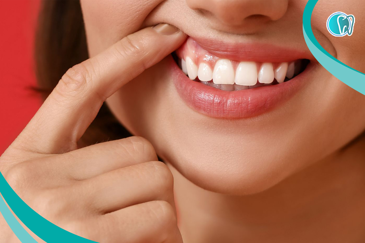 حساس شدن لثه در بیماران خاص