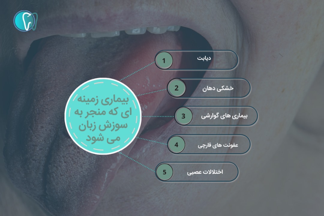 علت سوزش زبان