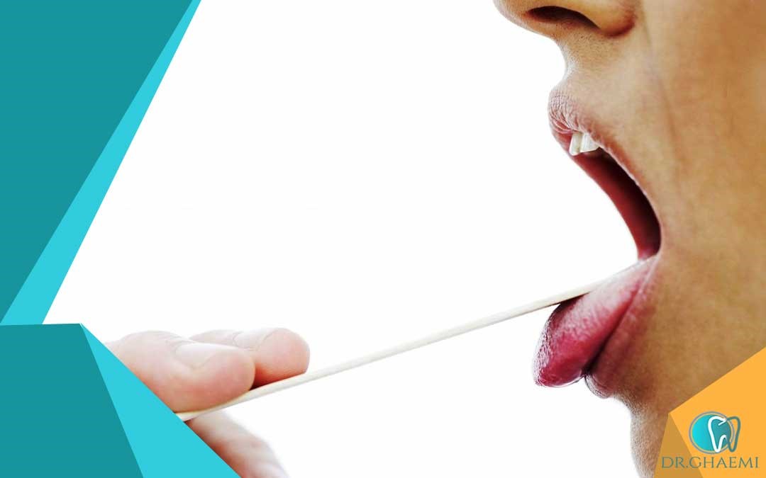 آزمایشهای تشخیصی برای سوزش دهان